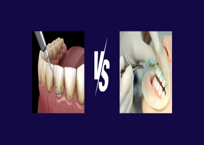 teeth scaling vs teeth whitening